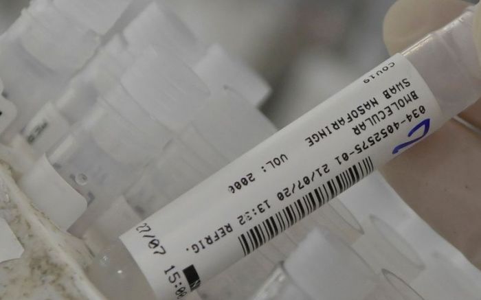 Em 2020, a doença provocou 1207 óbitos em menores de idade (Foto: Agencia Brasil)