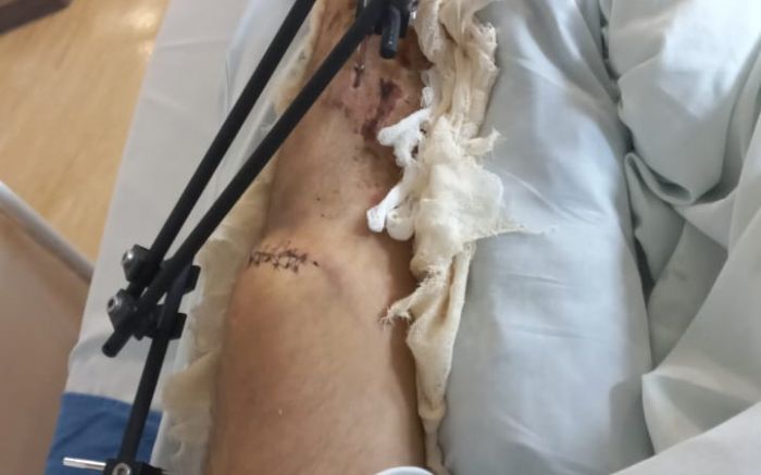 Mãe do jovem denuncia descaso do hospital; cirurgia já foi cancelada duas vezes
(Foto: Leitor)