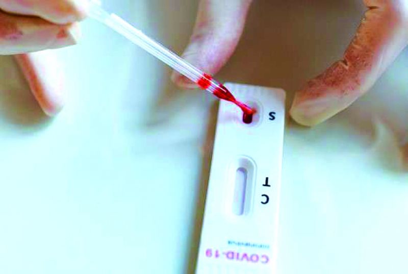 Itajaí e Navegantes entre as 10 cidades com mais casos ativos entre 12 e 18 de novembro