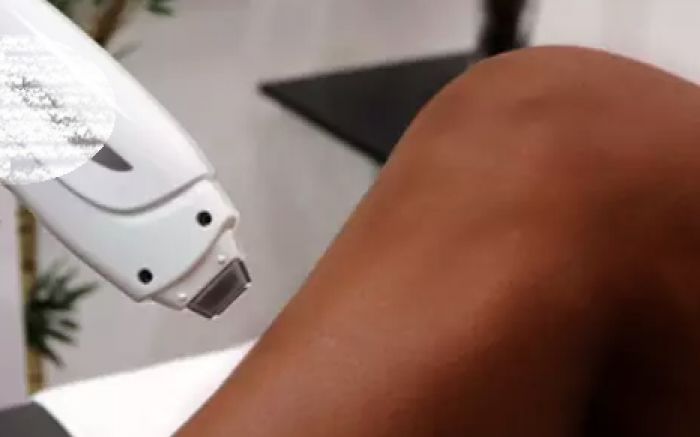 Mulher negra teve o atendimento negado e denuncia clínica de depilação
(Foto: Ilustrativa)