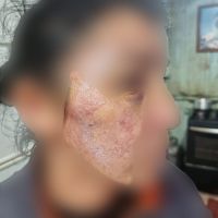 Mulher agredida pelo marido é resgatada