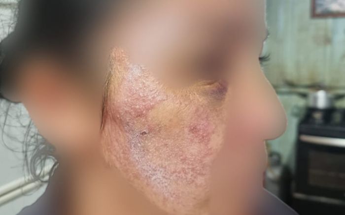 Vítima foi encontrada com hematomas e queimaduras
(Foto:
Divulgação)