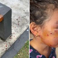 Pitbull ataca menina de três anos em pracinha; veja o vídeo  