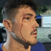 Dono de famosa boate LGBTQIA+ é agredido em Balneário Camboriú  