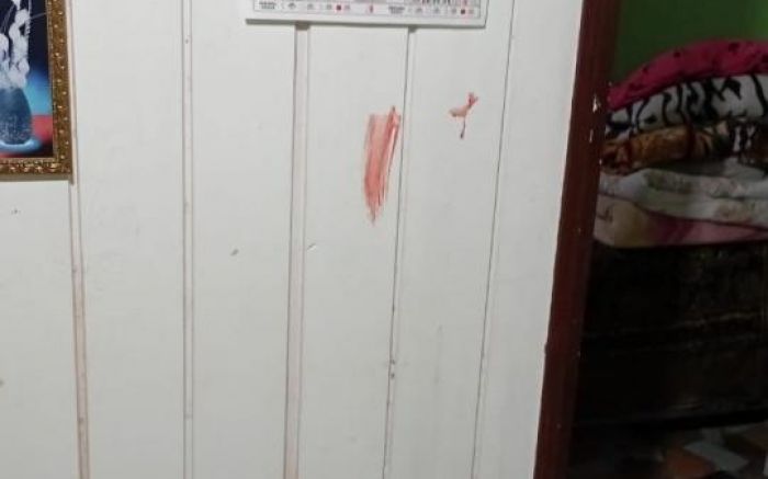 O corte na mão esquerda precisou ser tratado ainda no local (Foto: Divulgação BPMI)