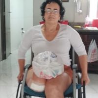 Família faz vaquinha pra comprar prótese pra moradora da Vila Operária