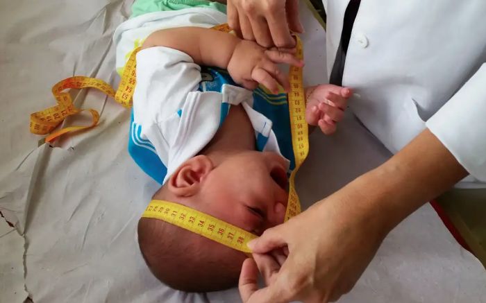 Famílias de crianças com síndrome do Zika vírus terão direito a indenização